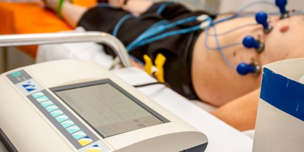 Electrocardiogram (ECG / EKG)