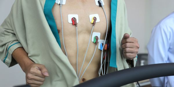 Holter Monitoring